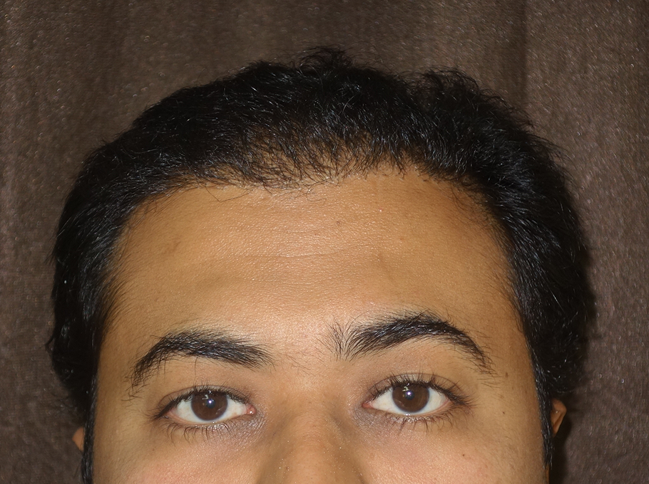 1after