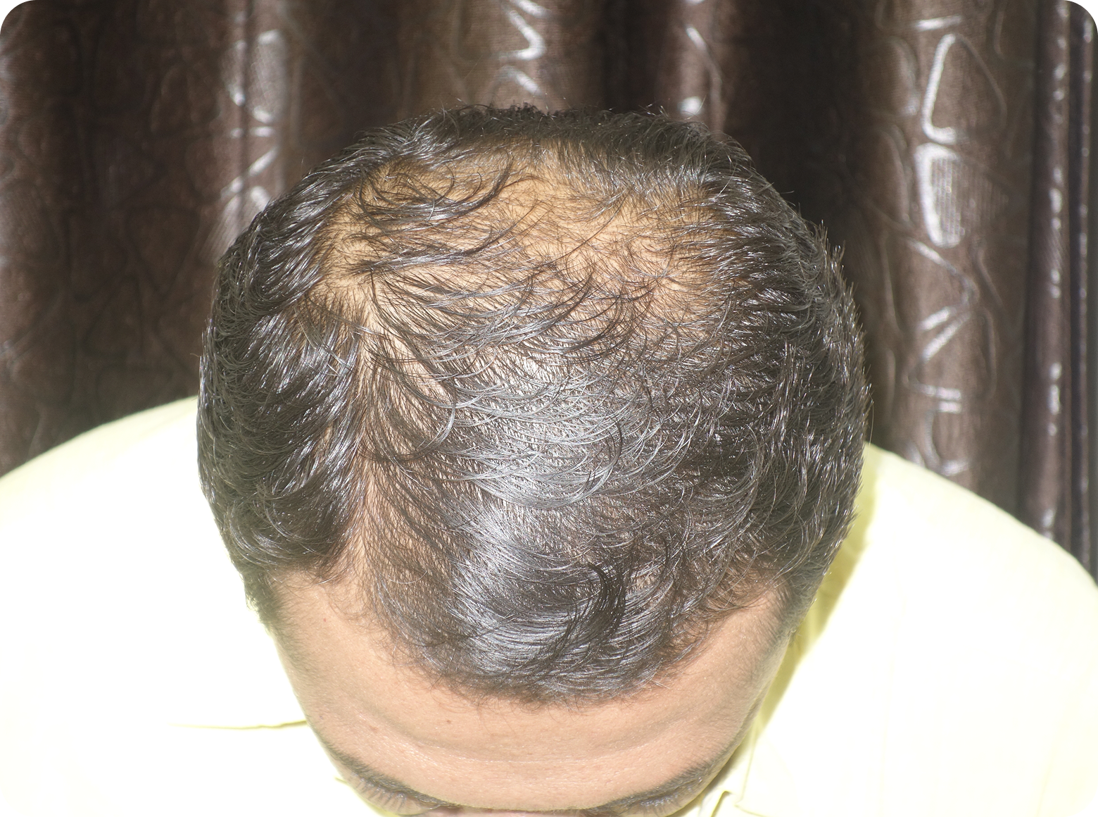 2after