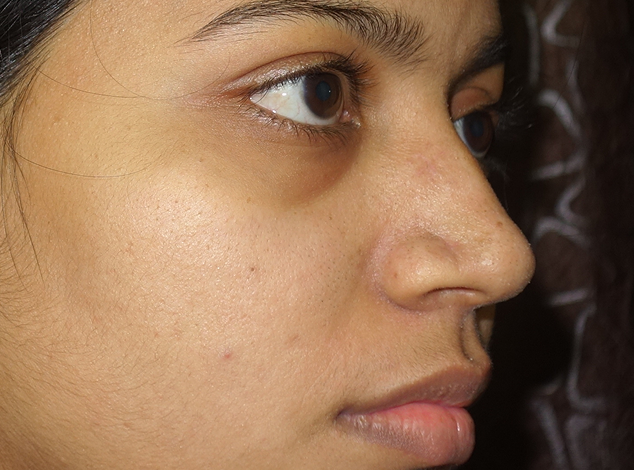 2after