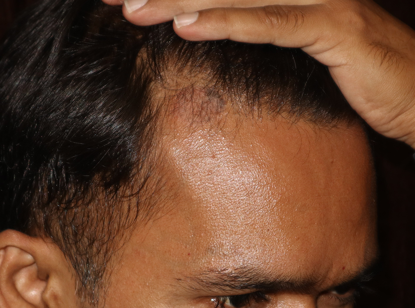 2after