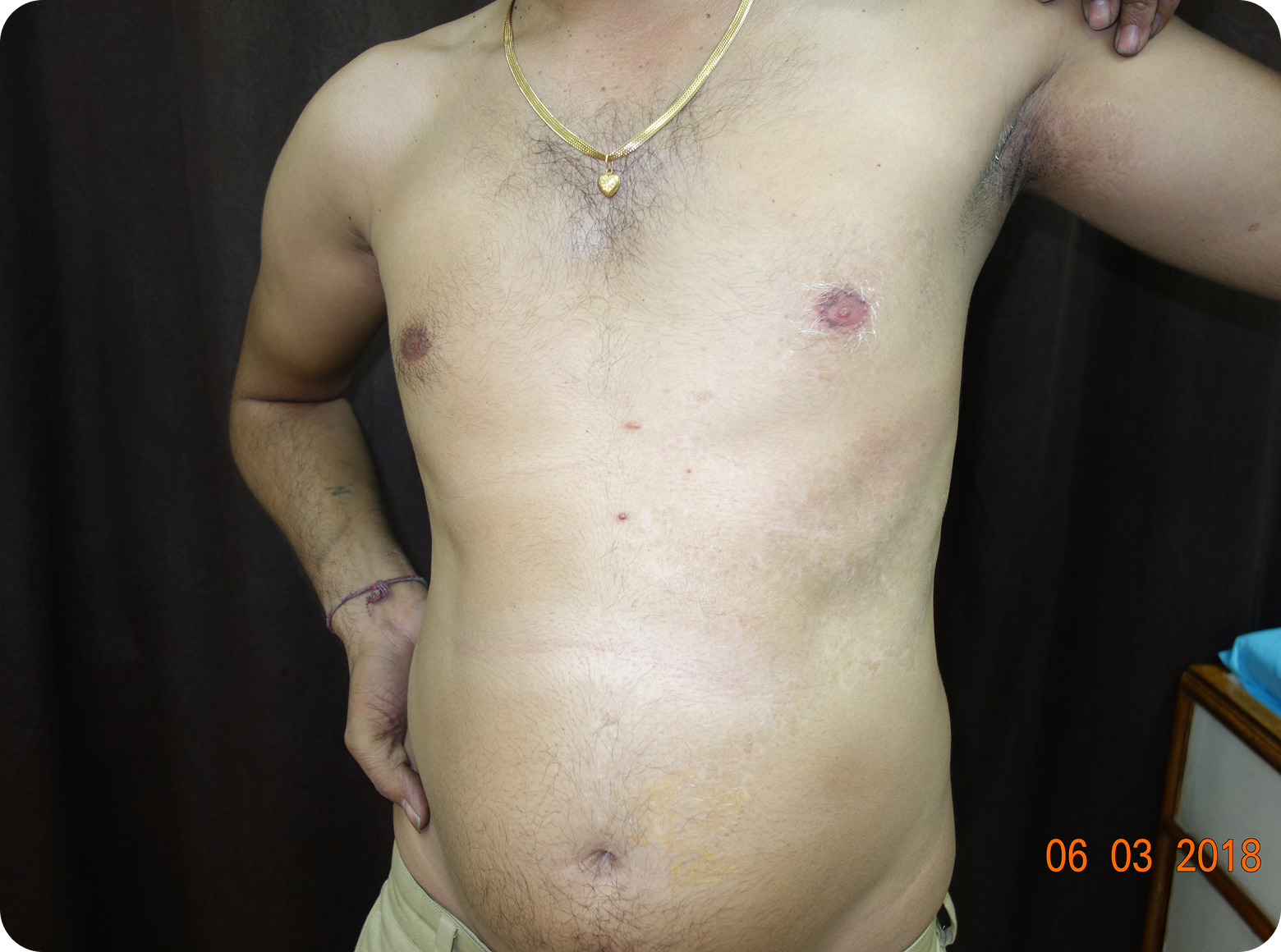 6after