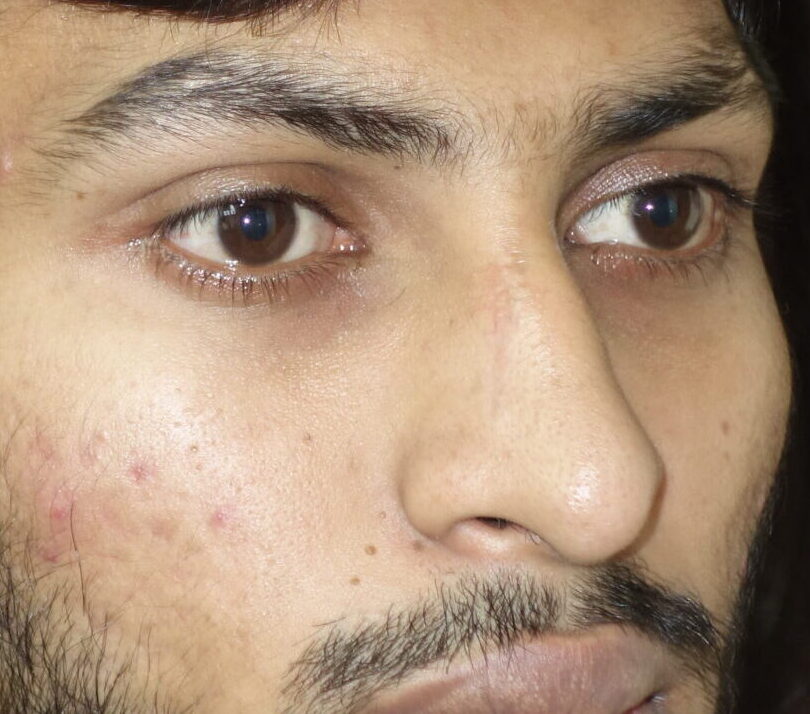 dhruvil mordiya (21)