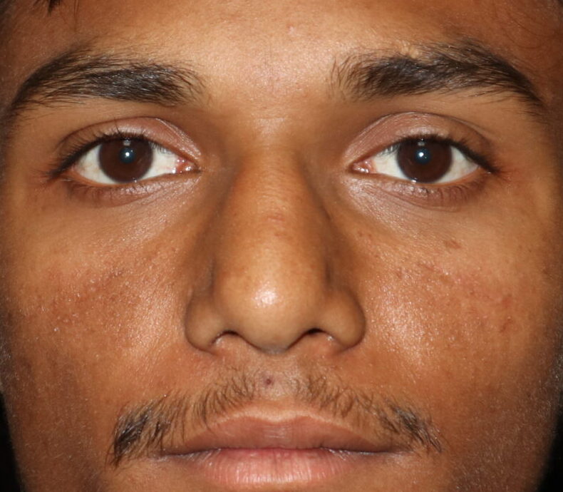 rakesh patel (82)