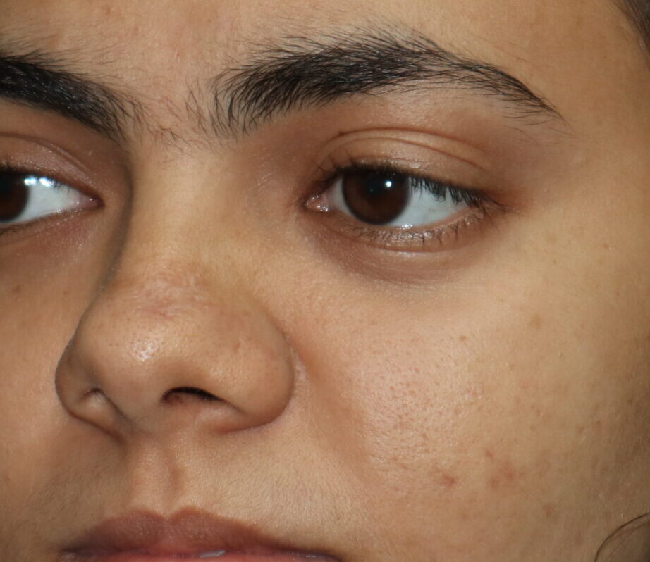 yashvi thakur (102)